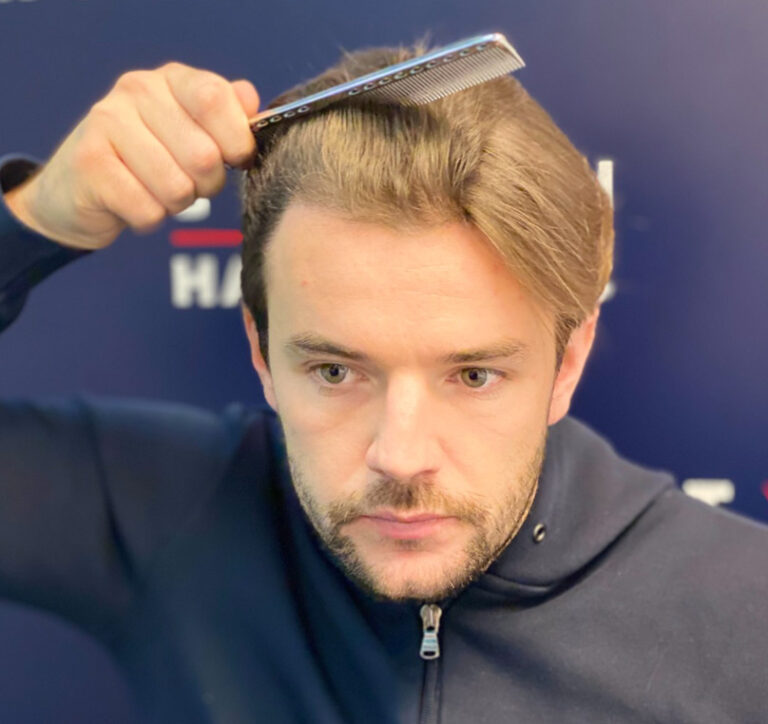 Nathan Massey - Essex - British Hair Clinic