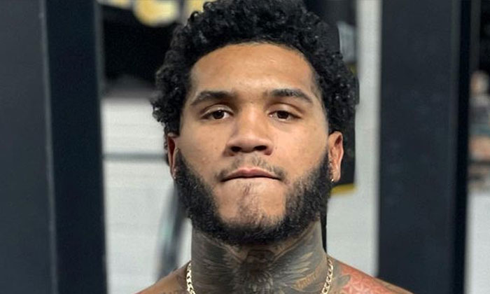 British Hair Clinic - Conor Benn - Hair Transplant