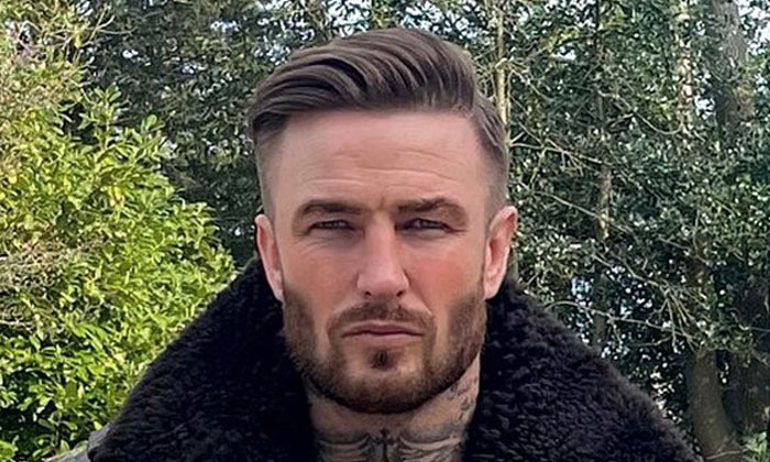 British Hair Clinic - Jamie Gleeson Hair Transplant