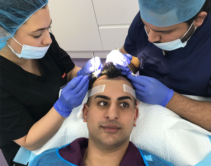 FUE Hair Transplant - Manchester - British Hair Clinic