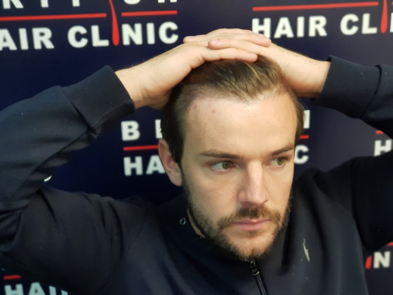 Nathan Massey - Essex - British Hair Clinic