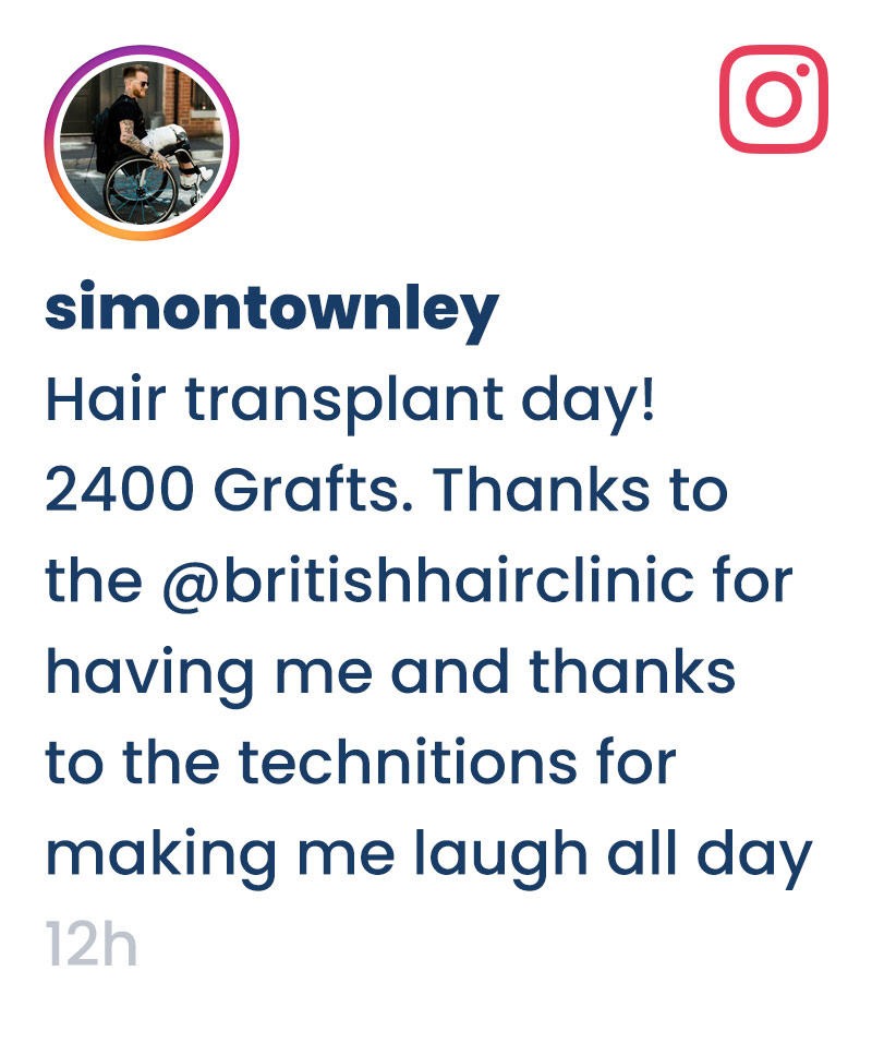 Hair Transplant Day