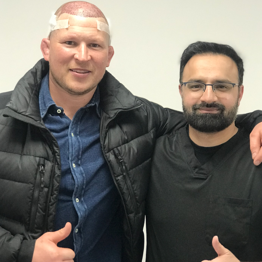 Dylan Hartley - England Rugby Star - Hair Transplant - British Hair Clinic