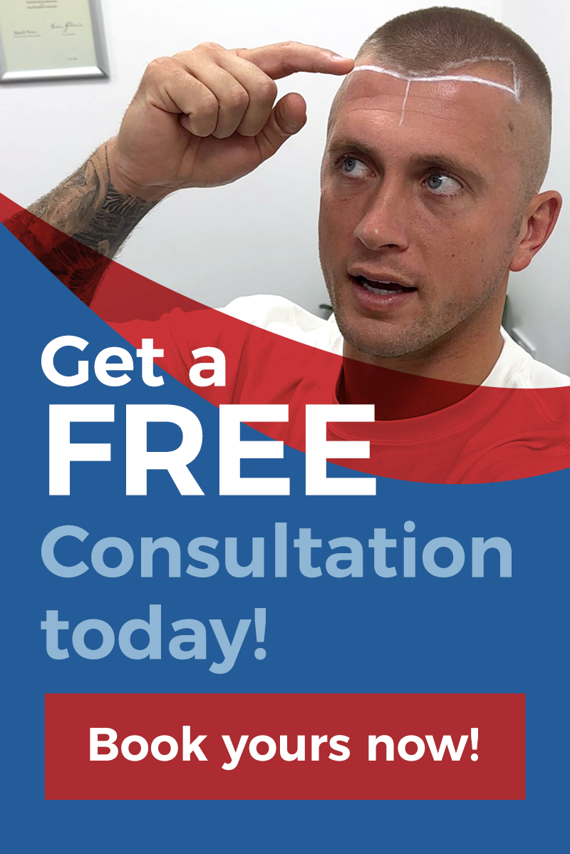 Prp Treatment British Hair Clinic Prp Treatment British Hair Clinic