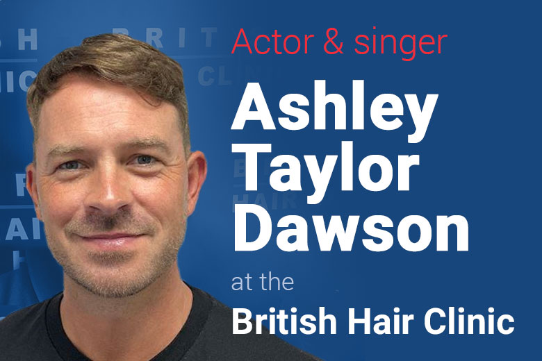 Ashley Taylor Dawson - Hair Transplant - Essex - Manchester - British Hair Clinic