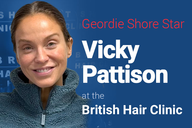 Vicky Pattision - Hair Transplant - British Hair Clinic