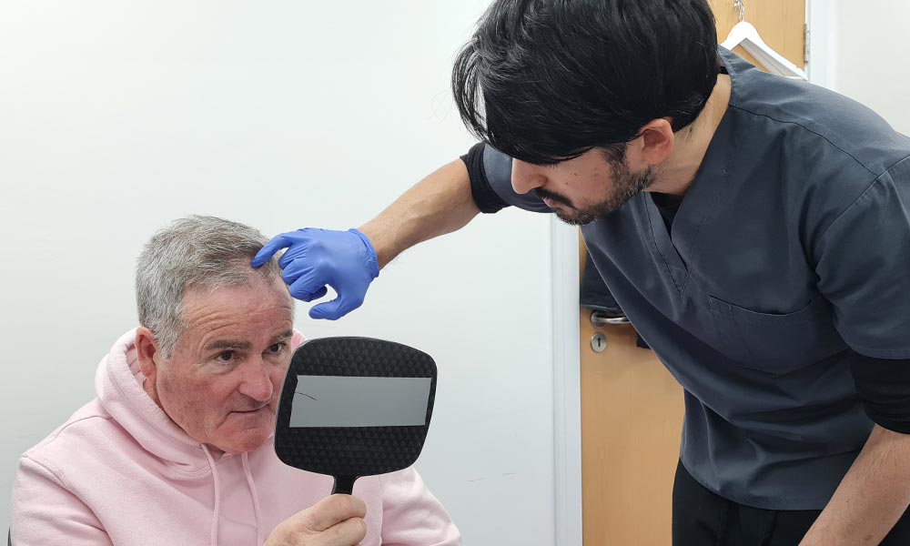 Hair Transplant Aftercare - British Hair Clinic