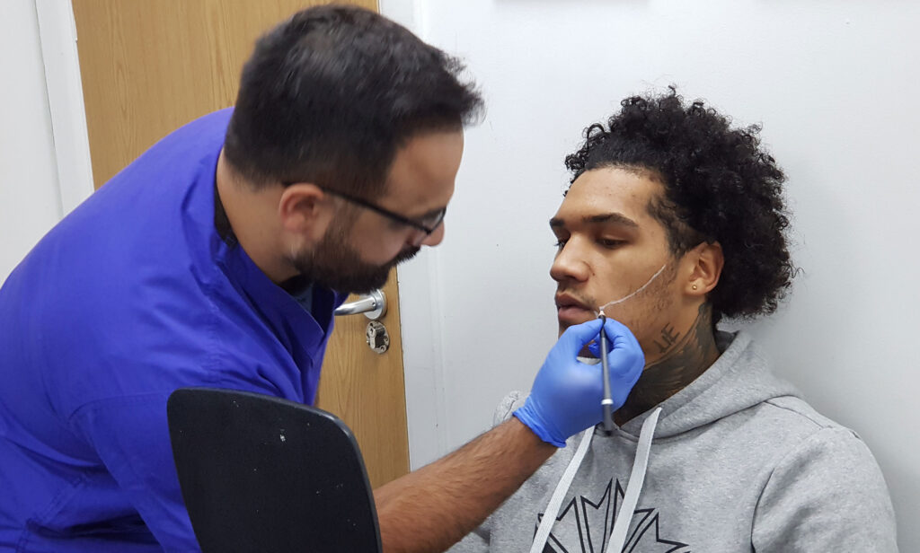 What Is A Facial Hair Transplant