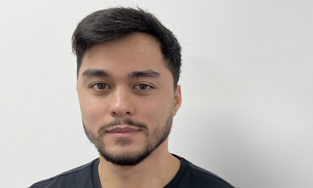 Will A Hair Transplant Result In Natural Looking Hair