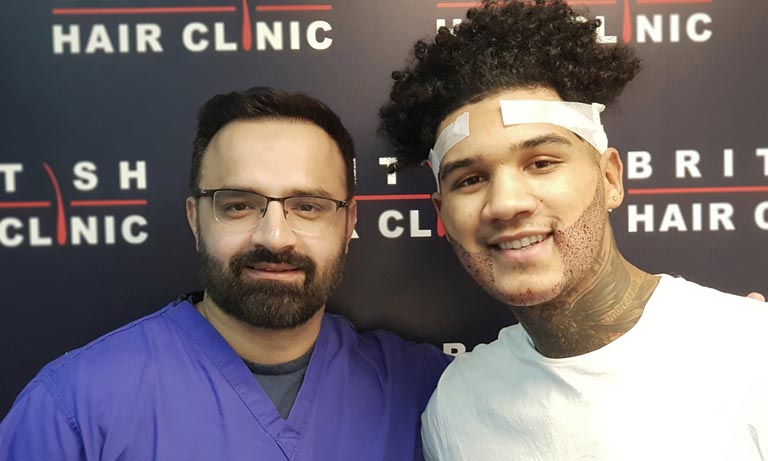 Wxcan Hair Transplants Help You Grow A Full Beard -What The Experts Say