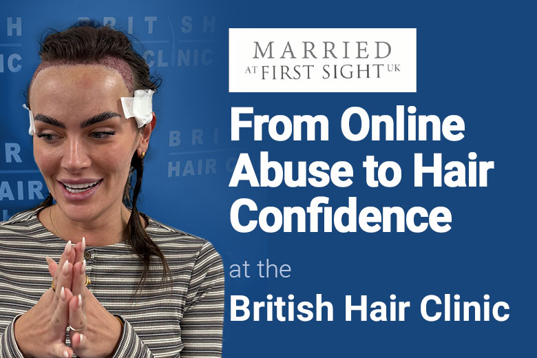 Amy Kenyon Speaks Out After Hair Transplant | British Hair Clinic