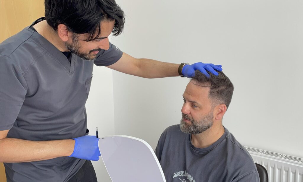 Does A Hair Transplant Result In Natural Looking Hair - British Hair Clinic