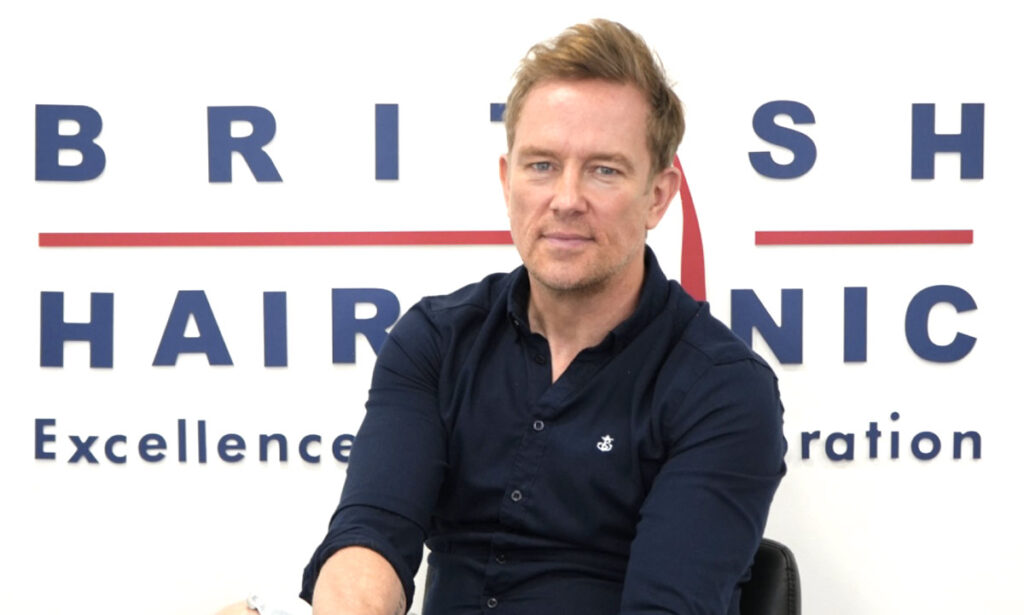 Simon Thomas - British Hair Clinic - Hair Transplant