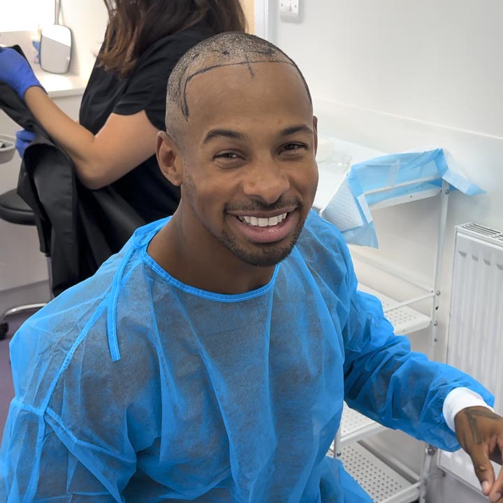 Celebrity Hair Transplant - Essex - FUE Hair Transplant - British Hair Clinic