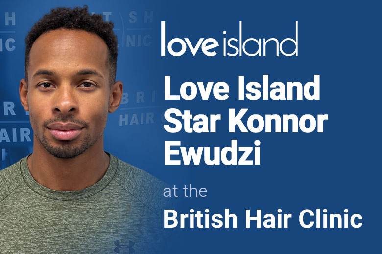 Konnor Ewudzi Hair Transplant - Celebrity Hair Restoration - FUE Treatment - British Hair Clinic